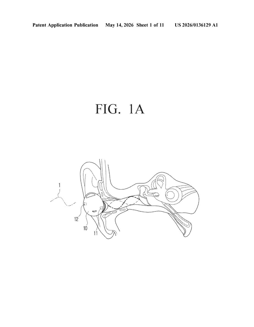 Samsung Patent: Smarter Active Noise Cancellation Tech — figure from US 2026/0136129 A1