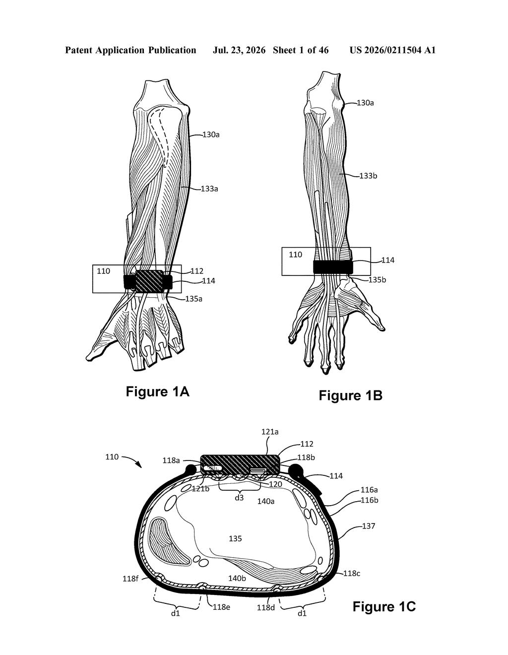 Meta Patent: Wristband Electrode Layout for Nerve Signal Reading — figure from US 2026/0211504 A1