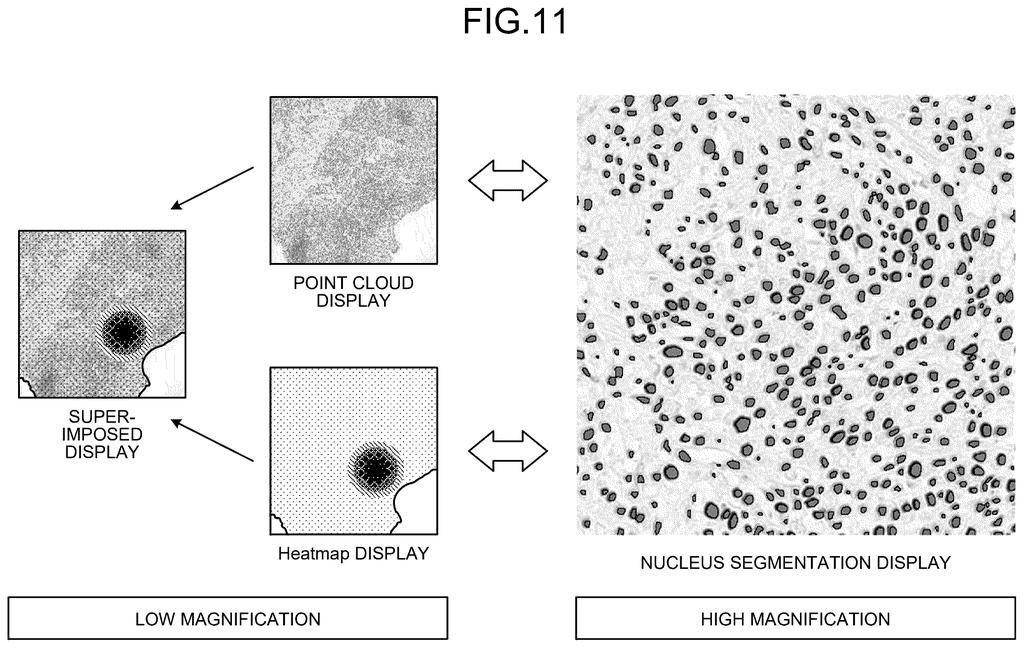 A tissue viewer shifting between a color-coded overview of an entire sample and a close-up of individual cells. Drawing from patent filing US 2026/0310886 A1.