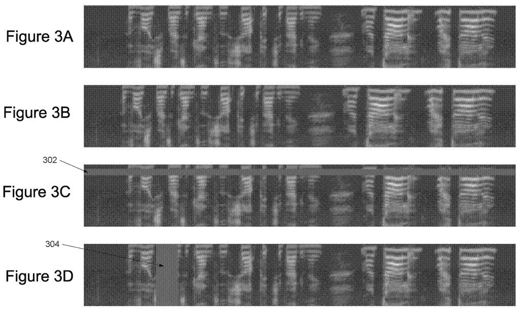 Sound recordings turned into visual patterns, with horizontal and vertical bars deleted so an AI learns to recognize muffled or missing speech. Drawing from patent filing US 2026/0310968 A1.
